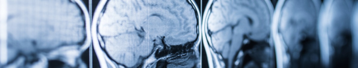 Non-invasive drug-free treatments for concussions, mental health, athletic performance improvements, and more in Denver!